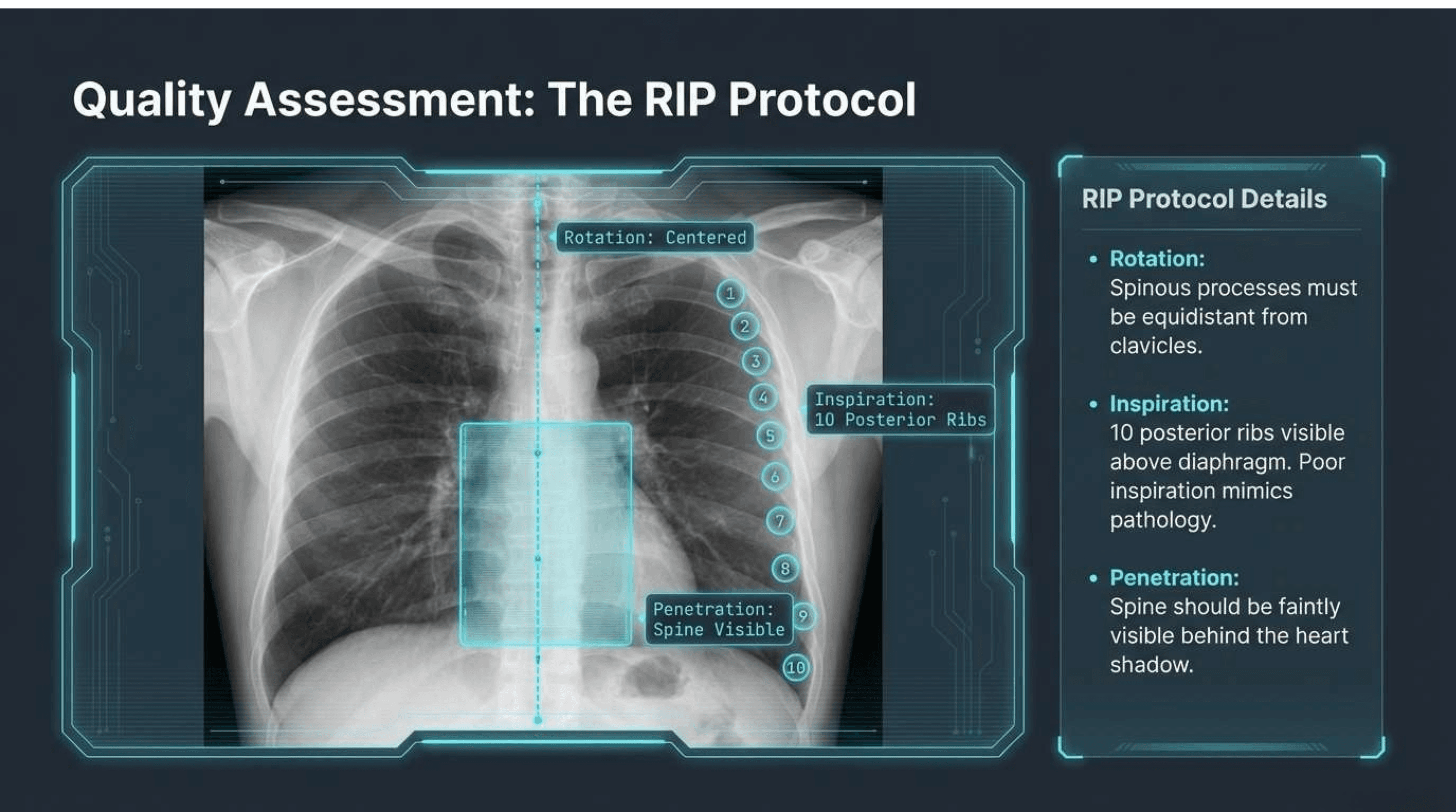 Slide 2 of CXR Interpretation: Reading Between the Ribs