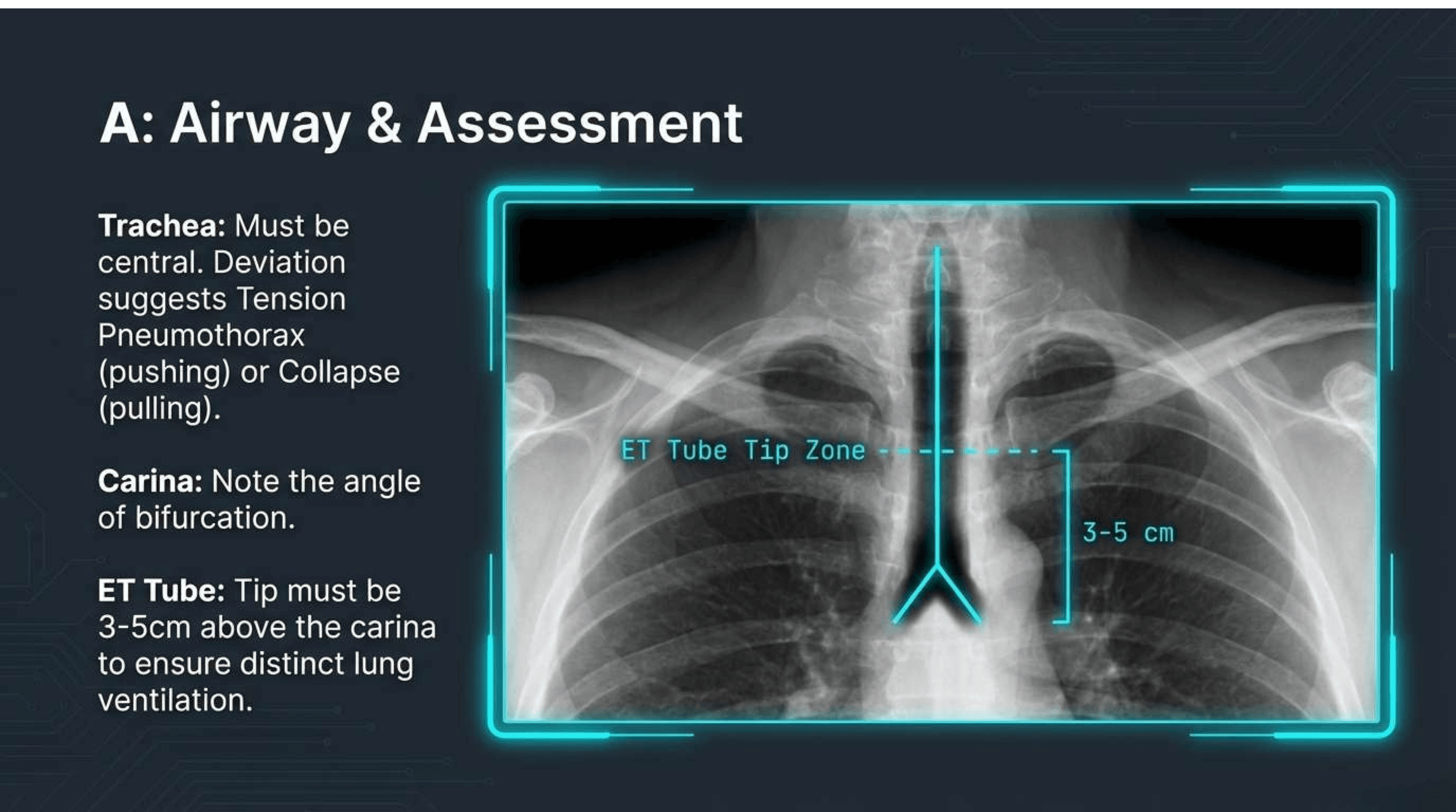 Slide 4 of CXR Interpretation: Reading Between the Ribs