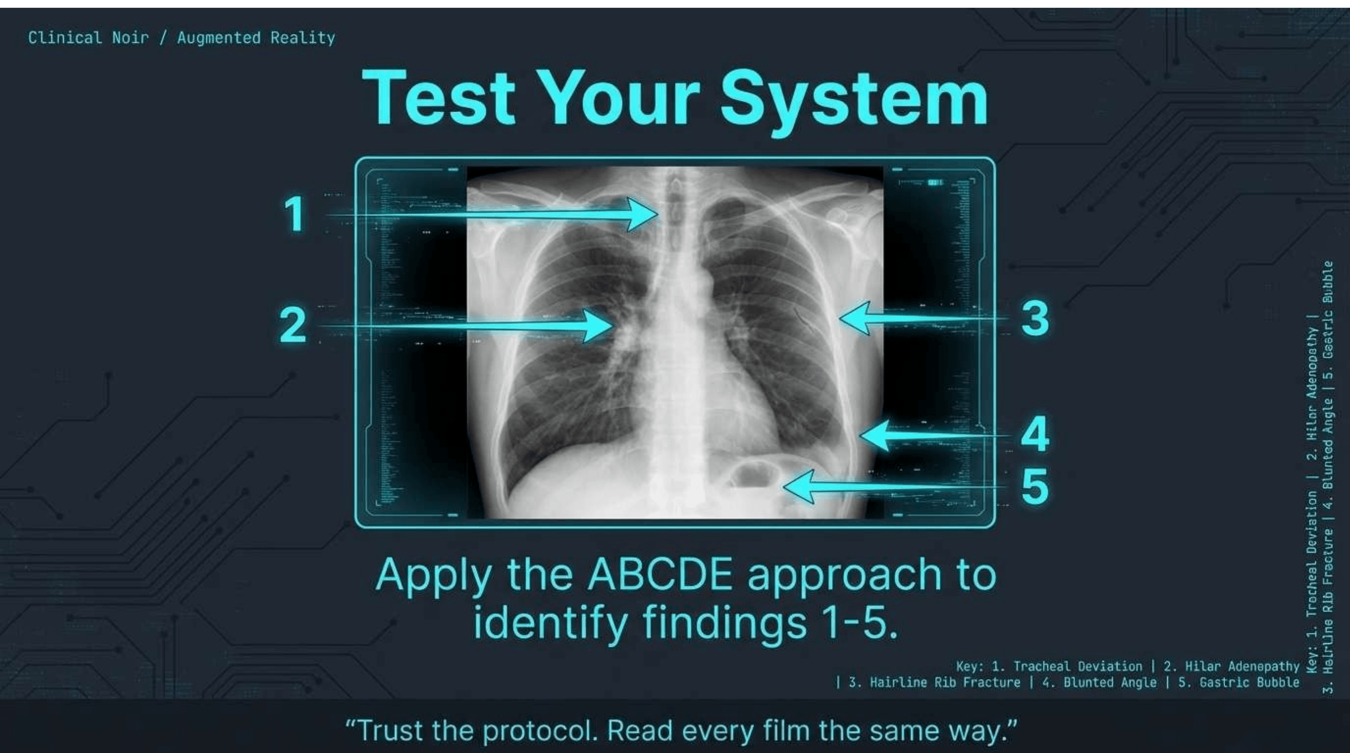Slide 15 of CXR Interpretation: Reading Between the Ribs